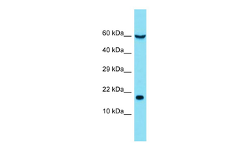 EIF5A Rabbit Polyclonal Antibody