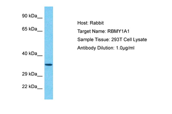 RBMY1A1 Rabbit Polyclonal Antibody