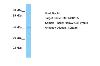 TMPRSS11A Rabbit Polyclonal Antibody