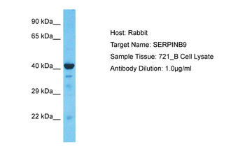 SERPINB9 Rabbit Polyclonal Antibody