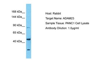 ADAM23 Rabbit Polyclonal Antibody