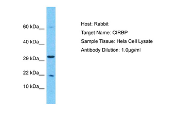 CIRBP Rabbit Polyclonal Antibody