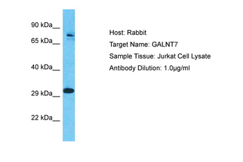 GALNT7 Rabbit Polyclonal Antibody