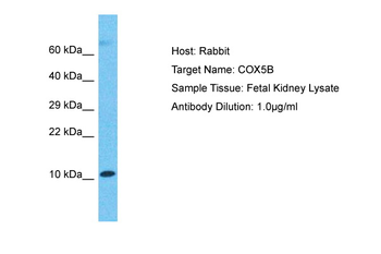COX5B Rabbit Polyclonal Antibody