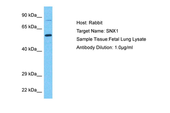 SNX1 Rabbit Polyclonal Antibody