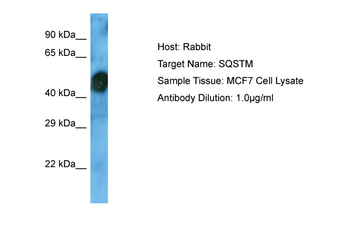 SQSTM1 Rabbit Polyclonal Antibody