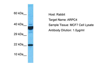 ARPC4 Rabbit Polyclonal Antibody