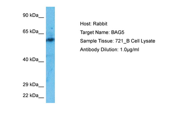 BAG5 Rabbit Polyclonal Antibody