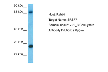 SRSF7 Rabbit Polyclonal Antibody