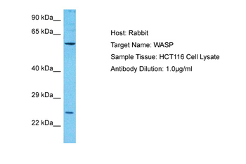 WAS Rabbit Polyclonal Antibody