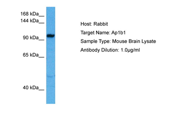 AP1B1 Rabbit Polyclonal Antibody