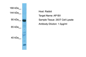 AP1B1 Rabbit Polyclonal Antibody