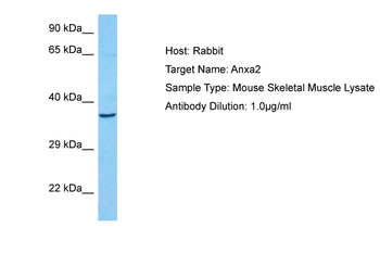 ANXA2 Rabbit Polyclonal Antibody