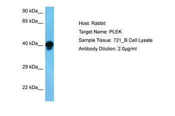 PLEK Rabbit Polyclonal Antibody