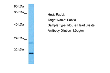 RAB6A Rabbit Polyclonal Antibody
