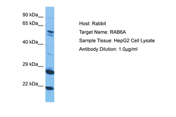 RAB6A Rabbit Polyclonal Antibody