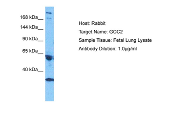 GCC2 Rabbit Polyclonal Antibody