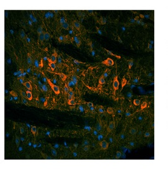 TH Rabbit Polyclonal Antibody