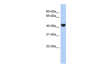 TH Rabbit Polyclonal Antibody