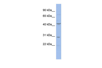 CCNE2 Rabbit Polyclonal Antibody