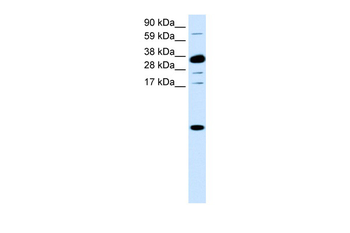 CXCL1 Rabbit Polyclonal Antibody