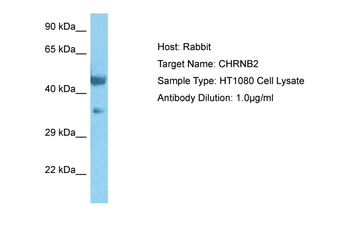 CHRNB2 Rabbit Polyclonal Antibody