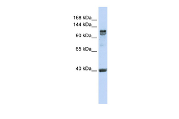 RFX1 Rabbit Polyclonal Antibody