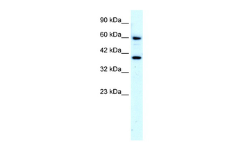 RORA Rabbit Polyclonal Antibody
