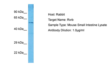 RXRB Rabbit Polyclonal Antibody