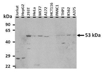 TFEB Rabbit Polyclonal Antibody