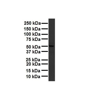 RARA Rabbit Polyclonal Antibody