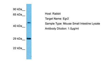 EGR2 Rabbit Polyclonal Antibody