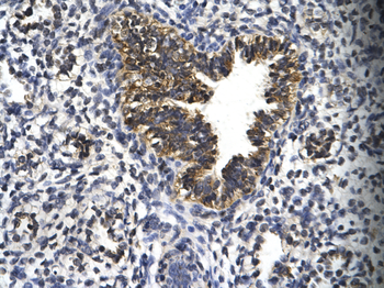 EGR2 Rabbit Polyclonal Antibody
