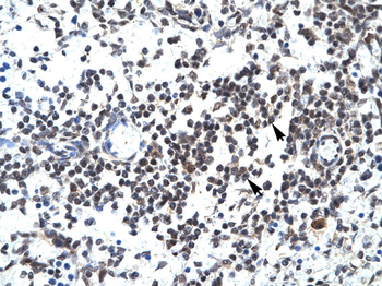 GABPB2 Rabbit Polyclonal Antibody