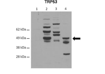 TRP53 Rabbit Polyclonal Antibody