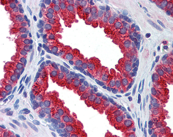 KL Rabbit Polyclonal Antibody