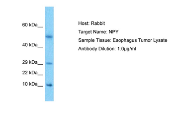 NPY Rabbit Polyclonal Antibody