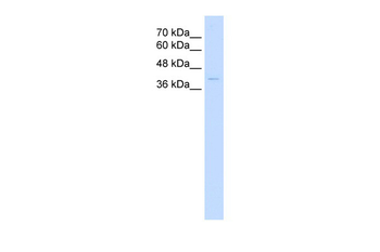 HP Rabbit Polyclonal Antibody