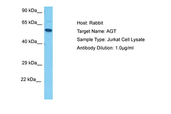 AGT Rabbit Polyclonal Antibody