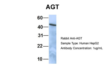 AGT Rabbit Polyclonal Antibody
