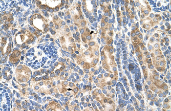 CDH3 Rabbit Polyclonal Antibody