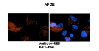 APOE Rabbit Polyclonal Antibody