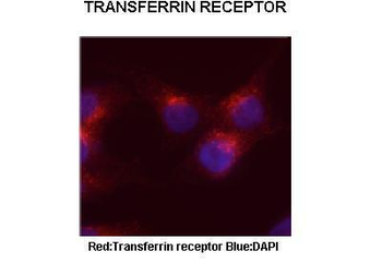 TFRC Rabbit Polyclonal Antibody