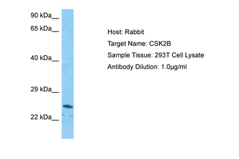 CSNK2B Rabbit Polyclonal Antibody
