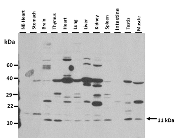 CXCL12 Rabbit Polyclonal Antibody