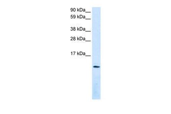 CXCL12 Rabbit Polyclonal Antibody