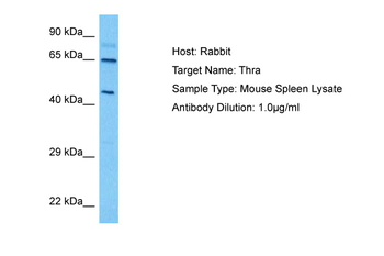 THRA Rabbit Polyclonal Antibody
