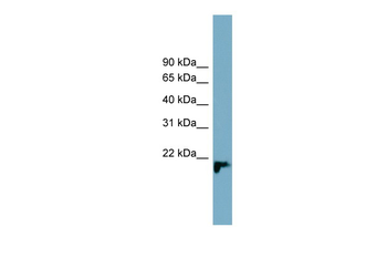 PRXL2B Rabbit Polyclonal Antibody