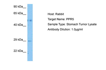 PRR5 Rabbit Polyclonal Antibody