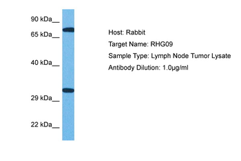 ARHGAP9 Rabbit Polyclonal Antibody